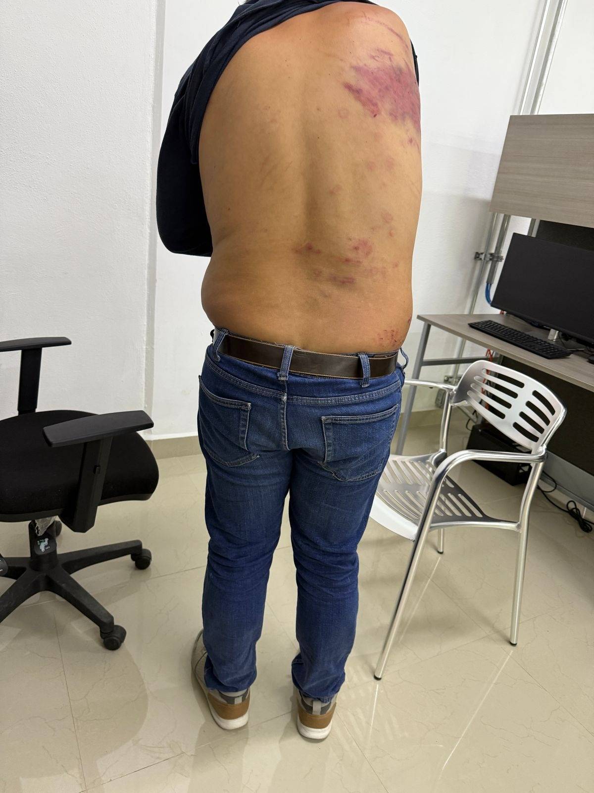 Foto: Especial lesiones mostradas por el detenido a sus abogados